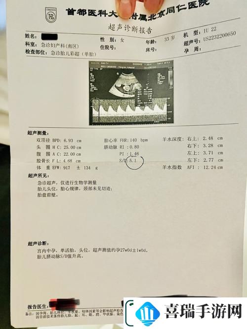 “OVO食肉族报告4”